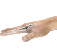 Artificial Finger Joint Replacement