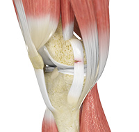 Ligament Injuries