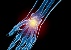 Sports Injury Management of Hand, Wrist and Elbow